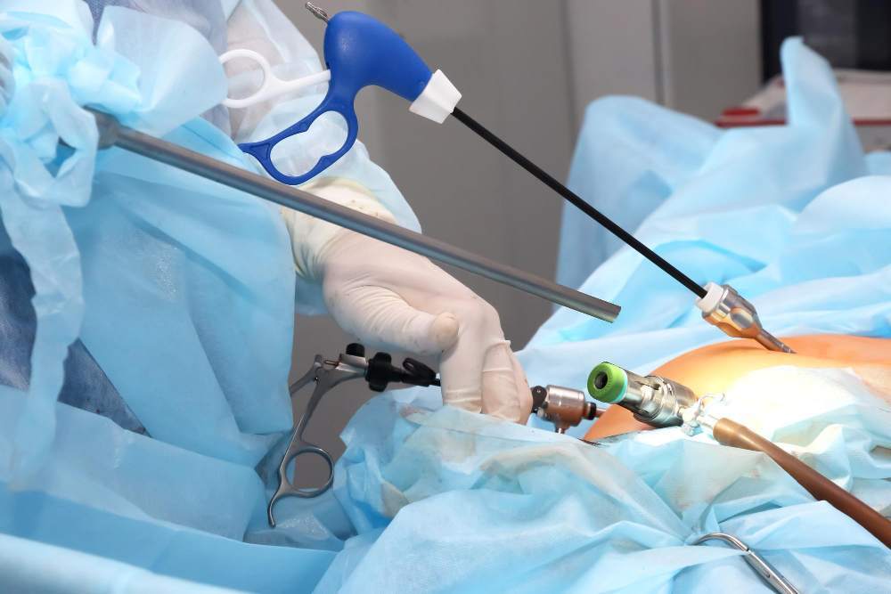 Laparoscopic Ovarian Cystectomy